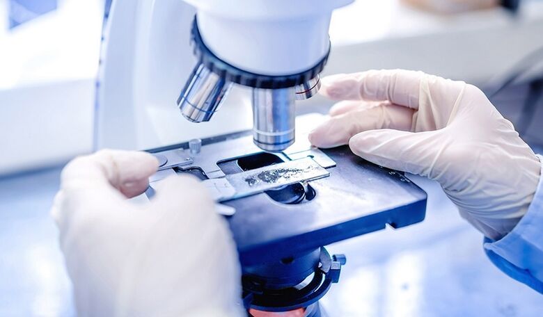 laboratórna diagnostika plesní nechtov na nohách