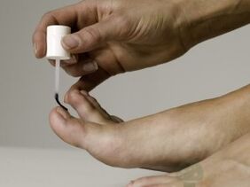 Ošetrenie húb nechtov