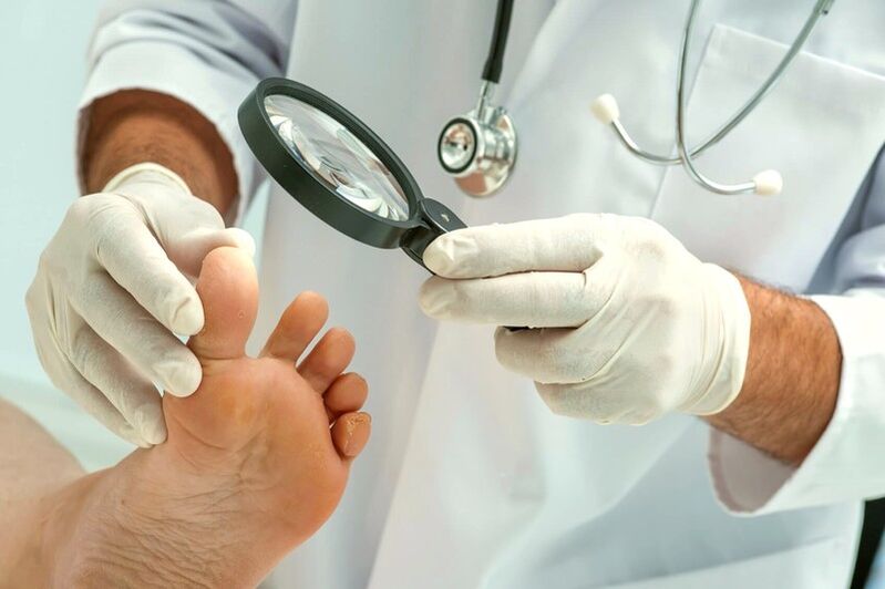 dermatológ vyšetrujúci nechty na nohách