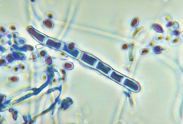 Huba Trichophyton rubrum pod mikroskopom